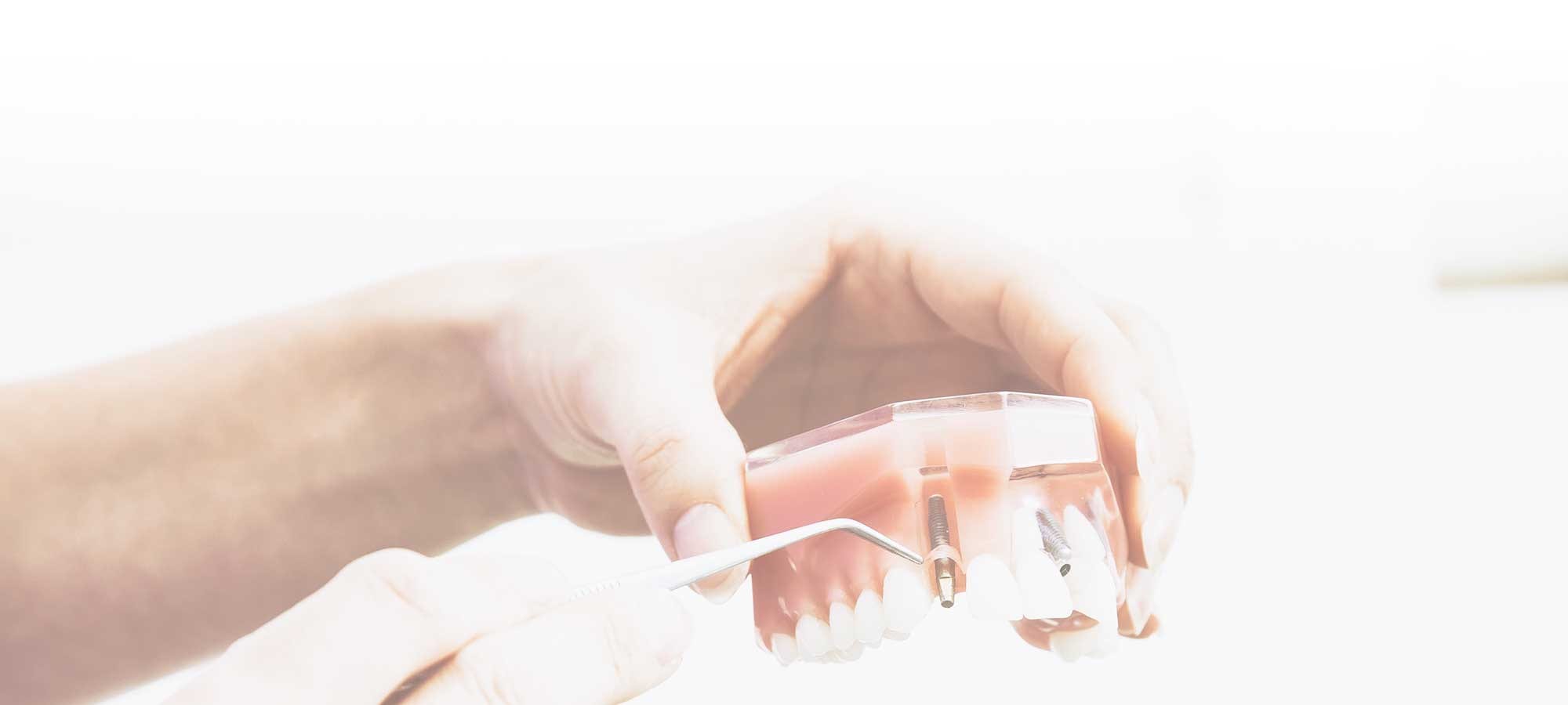 reno nv dentist, tooth extractions