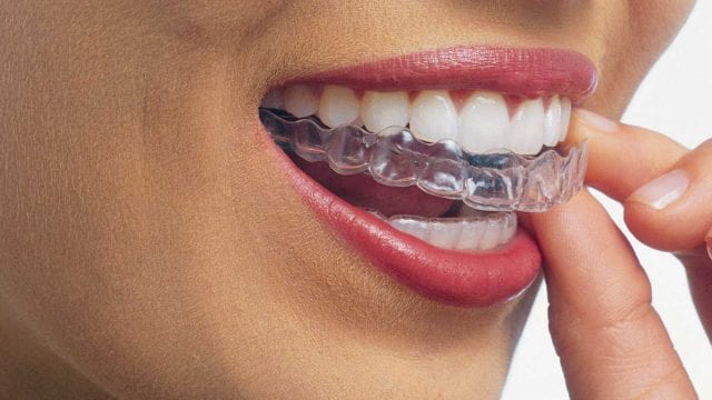 Invisalign Reno, reno nv dentist