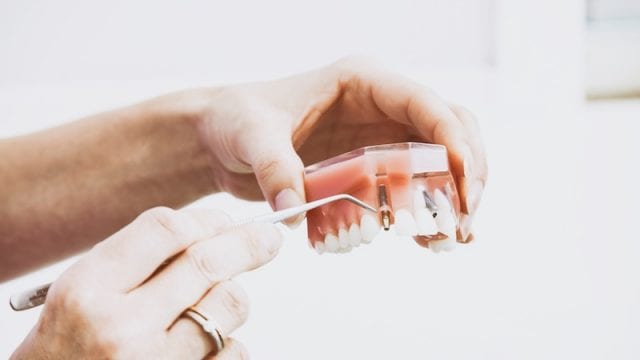 How to Care for a Cracked Tooth, reno nv dentist