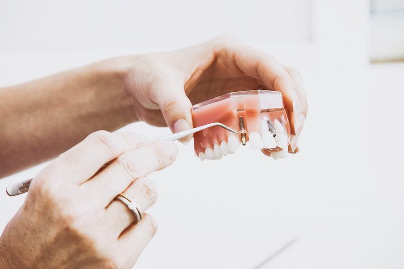 How to Care for a Cracked Tooth, reno nv dentist