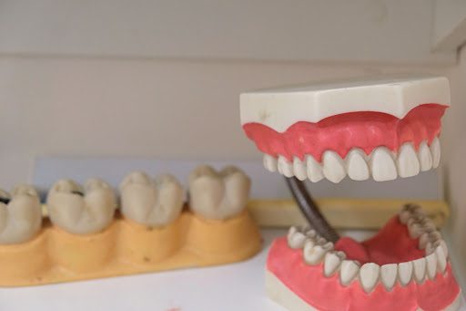 A set of dentures being prepared in a mold.