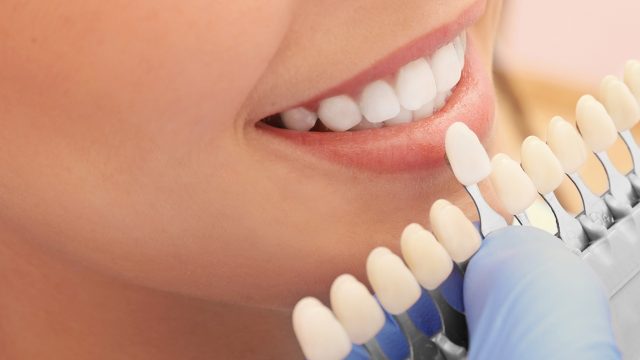Kulesa Dentistry exploring the different types of dental fillings offered by Jon A Kulesa.